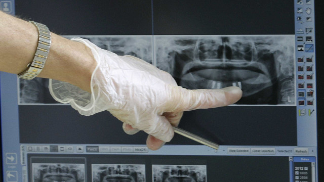 PS proposes dental care and mental health as basic SNS services