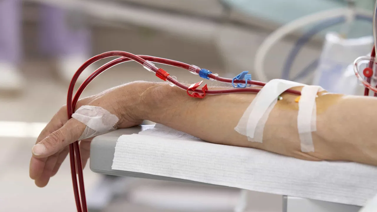 Association warns of "very difficult times" for dialysis clinics