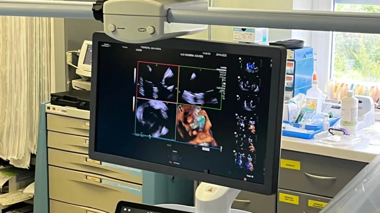 Innovative. Coimbra's ULS performs procedures with 4D ultrasound.