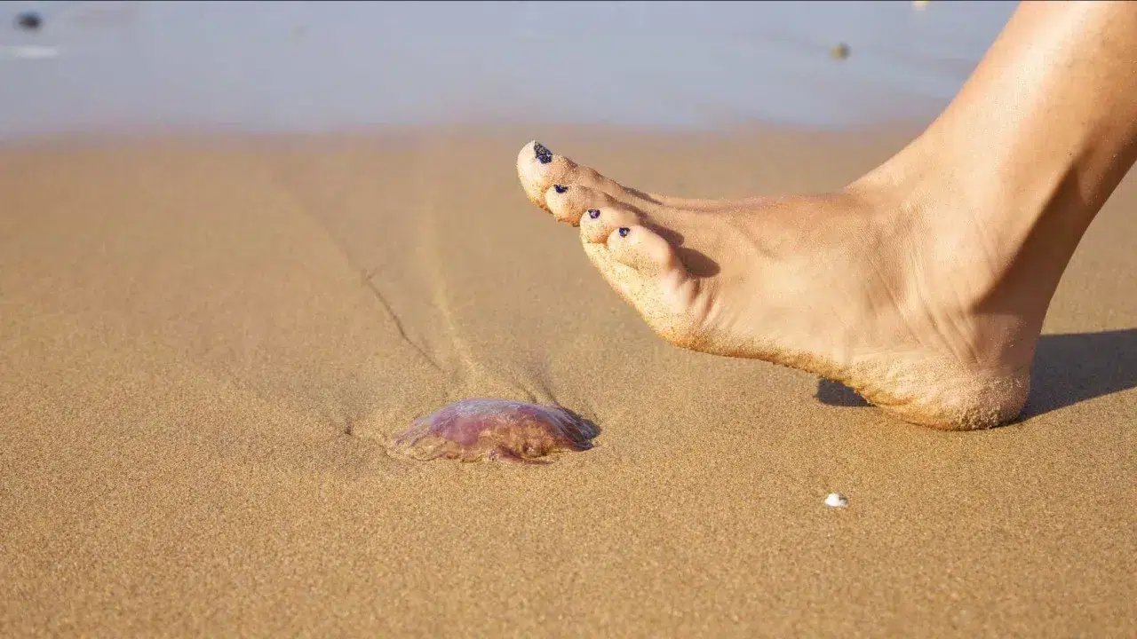 Do you know what to do in case of a jellyfish sting? Now recall
