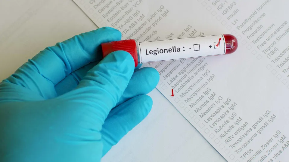 Suspicions of Legionella 'close' municipal pools in Maia