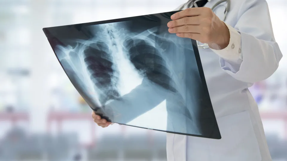 Lung cancer screening (the deadliest in the world) at ULS Gaia/Espinho