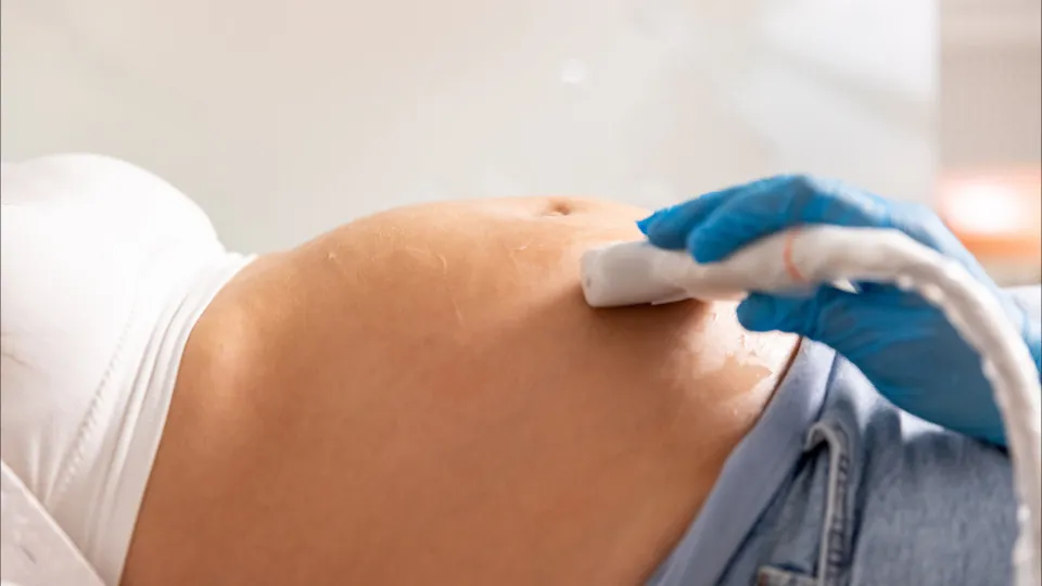 Nurses start monitoring pregnant women in Setúbal in the first trimester of 2026.