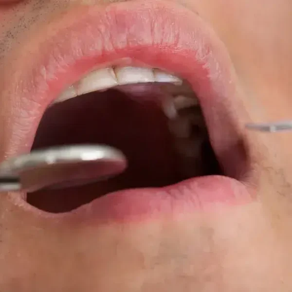 Regulator suspends dental practice activity in Figueira